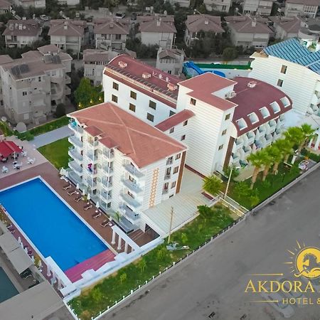 Akdora Resort&Spa Side Dış mekan fotoğraf